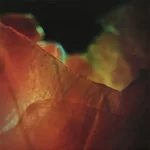 SKIN004-FRONTCOVER Kimchi Slap