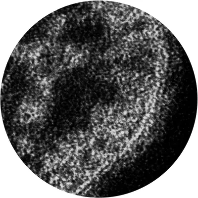 Grey Matter Ep (Clear & Black Mixed Vinyl)